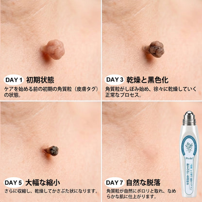 公式ショップ🧴🎈𝐏i𝐜𝐝o® 7日間 シミ取り 傷跡ケア ペン(痛みゼロ、傷ゼロのローラーボール)💪